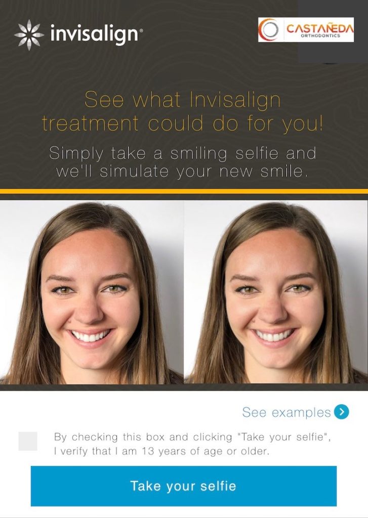 Invisalign – Show your Style with your Smile